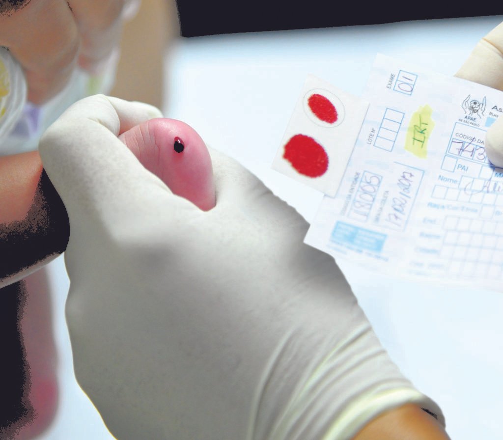 Descrição da imagem #PraCegoVer: A imagem está no formato quadrado. Nela é possível ver a realização do Teste do Pezinho. Uma profissional da área de saúde faz a coleta do material no pé de um bebê recém-nascido. Na imagem é possível ver a placa de coleta marcada pelo sangue da criança. Fim da descrição.