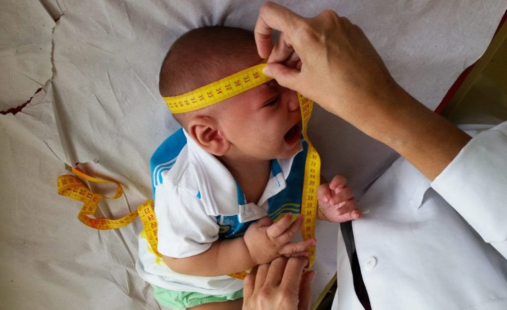 Descrição da imagem #PraCegoVer: Imagem no formato retangular, na horizontal. Nela temos um bebê sendo examidado por uma profissional da saúde. O bebê está deitado em uma maca e a profissional está medindo o tamanho de seu crânio com uma fita métrica. Fim da descrição.