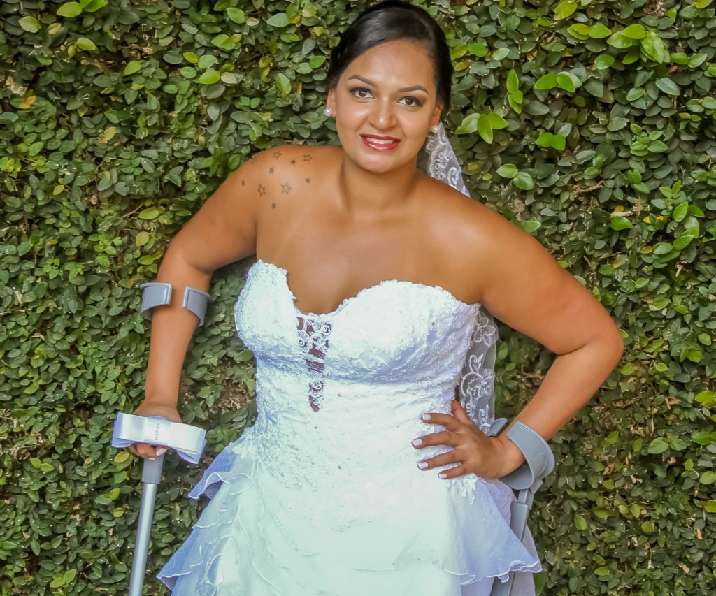 Descrição da imagem #PraCegoVer: Imagem no formato quadrado. Uma noiva está com seu vestido branco. Ela usa muletas. Fim da descrição.
