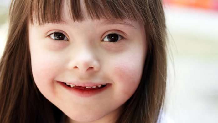 Descrição da imagem #pracegover: Uma linda menina que tem síndrome de Down. A menina é morena, e tem a pele clara e cabelos castanhos, lisos e compridos. Ela está sorrindo. Fim da descrição.