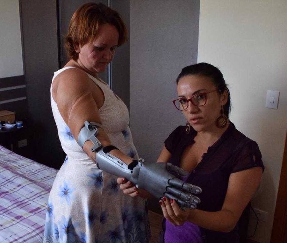 Descrição de imagem #PraCegoVer: Imagem no formato quadrado. A dona de casa Geisiane Buriola está experimentando uma prótese de mão. Uma mulher ajuda no processo de testes com a nova mão biônica. Fim da descrição.