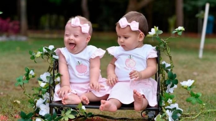 Descrição da imagem #PraCegoVer: Imagem no formato retangular, na horizontal. As irmãs gêmeas Luiza e Lívia. Luiza tem síndrome de Down. Elas estão sentadas lado a lado em um balanço, em um jardim. Fim da descrição.